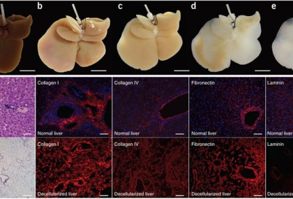 bionipechen 2
