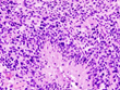 glibostoma