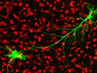 mikrogliia i neuron