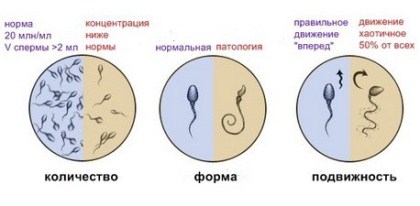 spermogramma